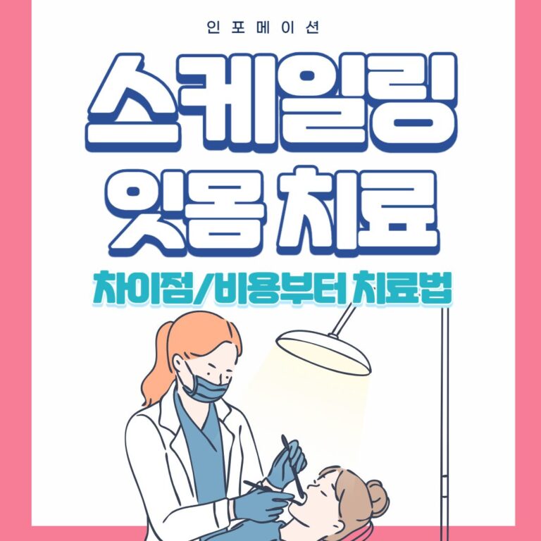 스케일링 비용
